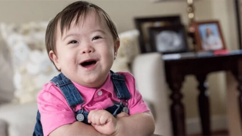 Does My Child With Down Syndrome Qualify For Financial Benefits does-my-child-with-down-syndrome-qualify-for-financial-benefits
