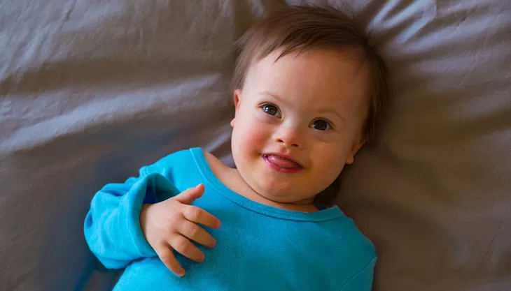 Can I Get Financial Benefits for My Child with Down Syndrome?